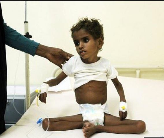 ‘Millions to die’ unless Saudi-led Yemen blockade ends – UN
