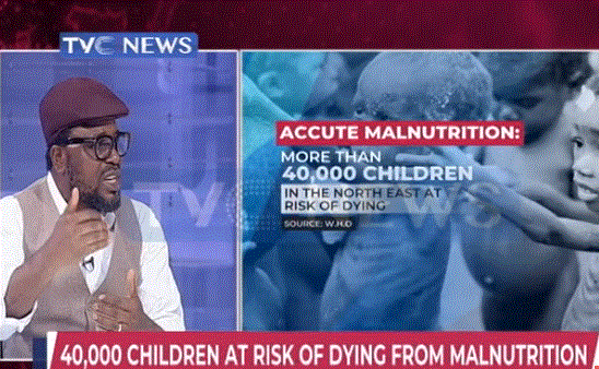 40,000 children risk dying of malnutrition, malaria and medical complications-WHO