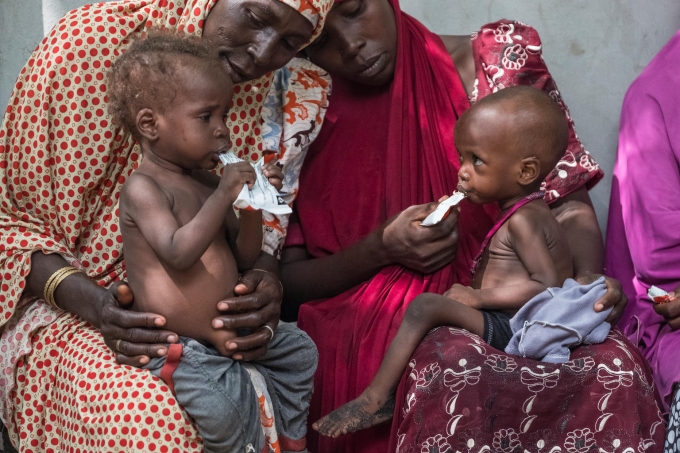 Two million Children suffer acute malnutrition in Nigeria – Official