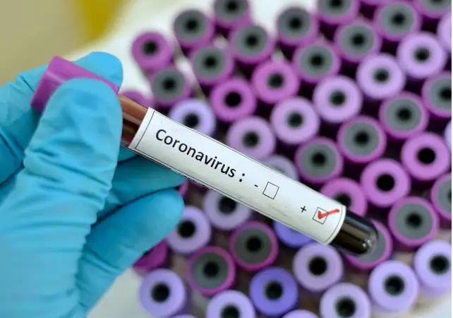 BREAKING: Nigeria confirms second case of Coronavirus