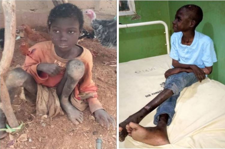 Police arrest father, others for allegedly chaining 11-yr-old boy for 2 years