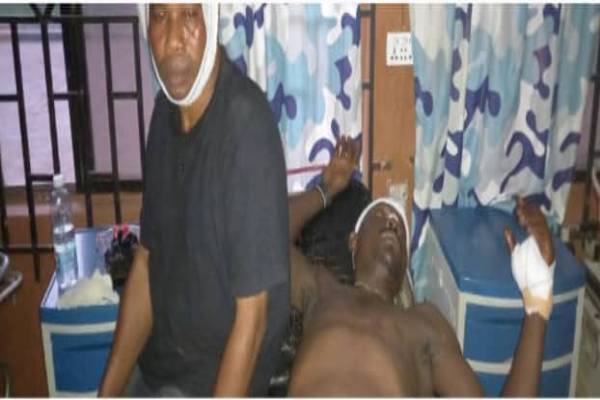 Six NURTW members injured in Ondo as hoodlums attack park