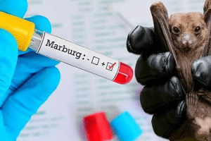 Ghana officially declares end to Marburg virus outbreak