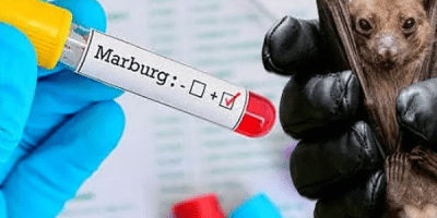Ghana officially declares end to Marburg virus outbreak