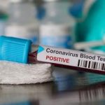 Nigeria records 35 new cases of COVID-19 infections